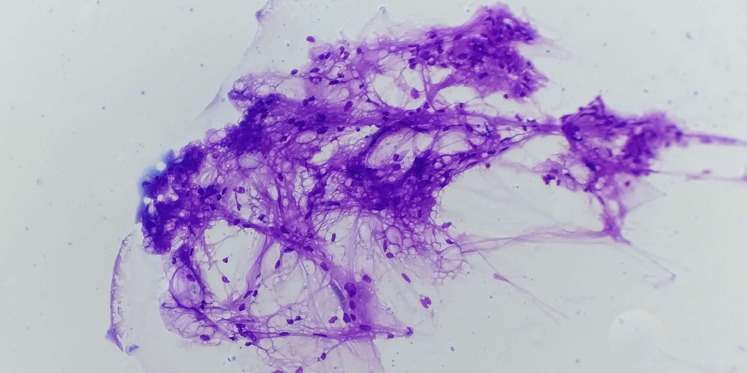 badania cytologiczne Zambrów cytologia